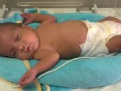 Parmak Bebek 100 Günde 6 Kat Kilo Alınca Taburcu Edildi