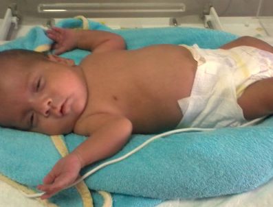 Parmak Bebek 100 Günde 6 Kat Kilo Alınca Taburcu Edildi