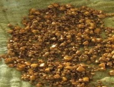 Bunlar safra kesesinden çıktı