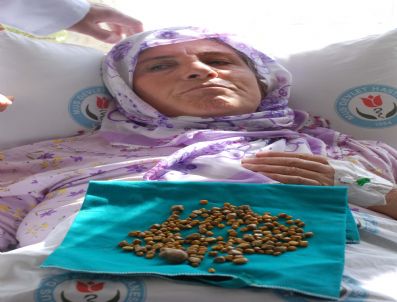 Safra Kesesinden 206 Adet Taş Çıktı