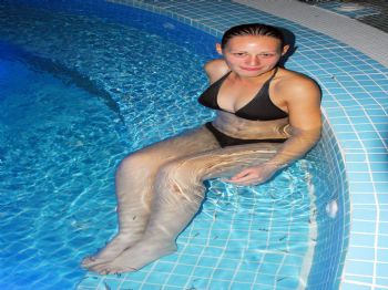 İLHAN ÖZBILEN - Doktor Balıklar Alanya`da