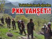 Acıya dayanamayıp kafasına sıktı!