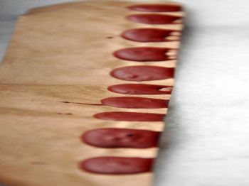 Çatapat Yutan Çocuğa Karaciğer Nakli Yapıldı