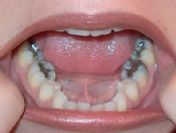 Ağzımızda zehir mi taşıyoruz?