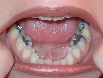 BIYOKIMYA - Ağzımızda zehir mi taşıyoruz?