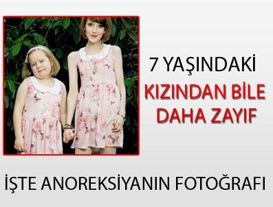 İşte anoreksiyanın fotoğrafı