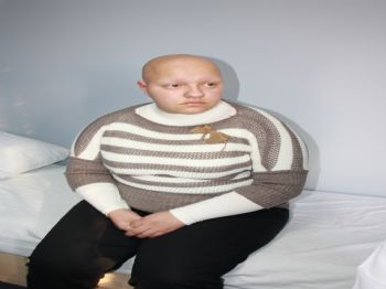 Depremde Dökülen Saçları 12 Yıldır Geri Gelmedi (özel)