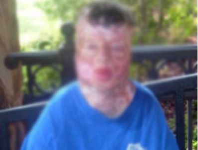 Yanan çocuk için 150 milyar dolarlık tazminat