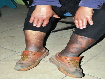 Yeşil Kartı İptal Edilen Hasta Yardım Bekliyor