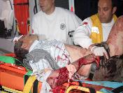 Erzincan‘da Trafik Kazası: 1 Ölü, 2 Yaralı