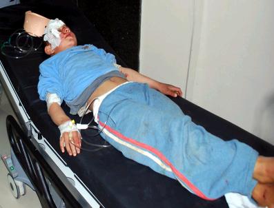 Nizip‘te Kaza: 2 Çocuk Yaralı