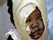 Pulitzer ödülünü kim kazandı?