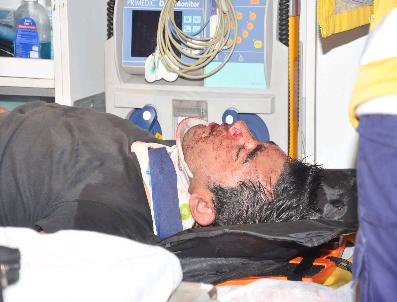 Apartmanın Beşinci Katından Düşen Hırsız Ağır Yaralandı