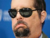 ABD'li askere yüz nakli yapıldı