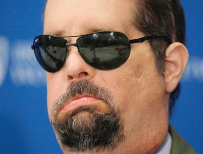 ABD'li askere yüz nakli yapıldı