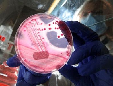 BRANDENBURG - Ehec bakterisi, 16 kişinin ölümüne sebep oldu