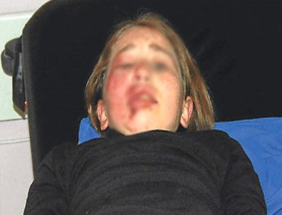 Yemeğin geç hazırlanmasına kızan alkolik baba kızını balkondan aşağı attı