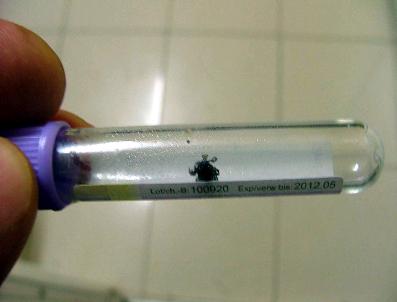 Sırtına Kene Yapışan Çocuk Hastaneye Kaldırıldı