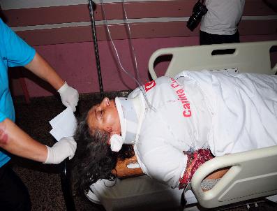 MADıMAK - Madımak Yangınında Ölenleri Anarken Canından Oluyordu