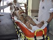 İki Ay Önce İnşaattan Düşen İşçiyi Elektrik Çarptı