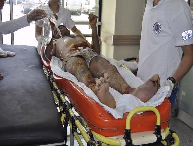 İki Ay Önce İnşaattan Düşen İşçiyi Elektrik Çarptı