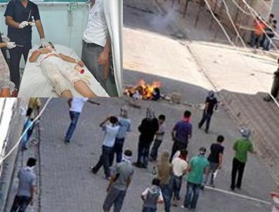 Silopi'deki protestolarda bir çocuk yaralandı