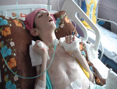 BALLıK - Trafik Kazasında Yaralanan Küçük Şenol