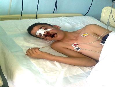 Emniyetten Gaz Bombası Yalanlaması