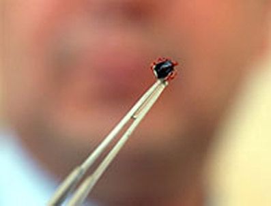 Sivas'ta kene'den ölüm