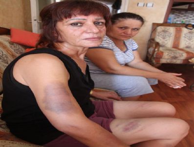 Kadına Koca Şiddeti İddiası