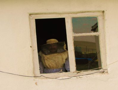 Anaflaksi Hastalığı Nedeniyle Maskesiz Dışarı Çıkamıyor