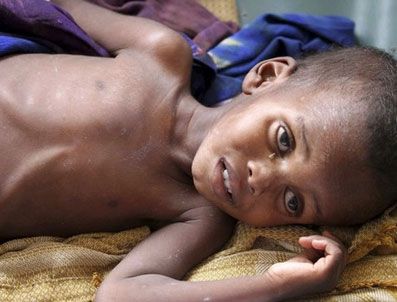 CIBUTI - Afrika Boynuzu, kuraklığın pençesinde