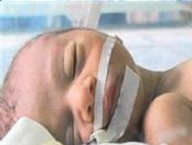 İbrahim bebek yaşama tutunamadı