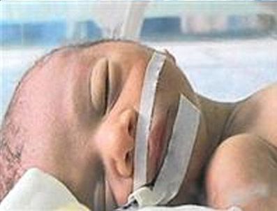 İbrahim bebek yaşama tutunamadı