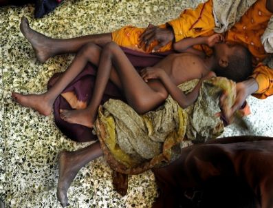 Somali’nin En Büyük Hastanesinde Her Gün 20 Çocuk Ölüyor