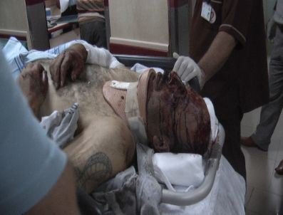 Beton mikseri petrol istasyonuna çarptı: 4`ü ağır 5 yaralı