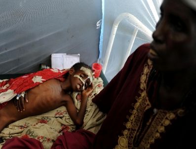 Somalili Anneler Çocuklarını Türk Doktorlara Emanet Edip Gitmek İstiyor