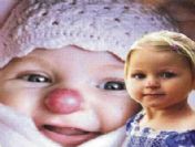 Palyaço burnundan ameliyatla kurtuldu