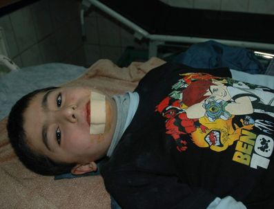 Kayseri`de Trafik Kazası: 2 Yaralı