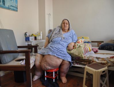 Fil Hastası Yaşlı Kadının İçler Acısı Hali