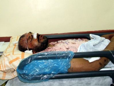 Motosikletle Otomobil Çarpıştı: 2 Yaralı