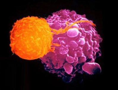 OSMAN İLHAN - Kanserli organdan kanser kök hücresi oluşturuldu