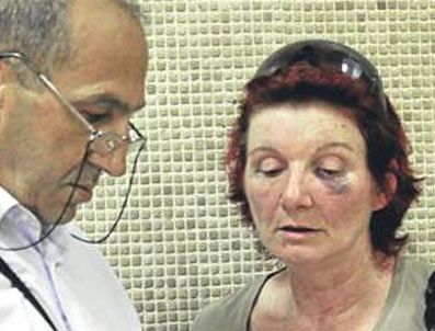 Kadına şiddeti böyle ti'ye aldı