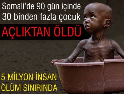 Somali'de 29 binden fazla çocuk öldü