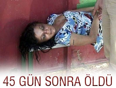 İşkence gören kadın yaşam savaşını kaybetti