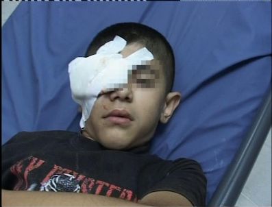 SERHAT BEDÜK - Pkk Yandaşları Tarafından Atılan Taş Küçük Çocuğu Yaraladı