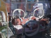 'parmak' Bebekler Ambulans Helikopterle Samsun'a Sevk Edildi