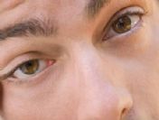 Göz seğirmesi neden olur?