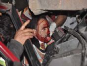 Konak'taki kazada yaralanan şahıs hayatını kaybetti