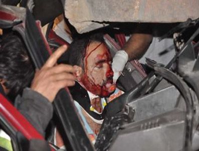 TEPECIK EĞITIM VE ARAŞTıRMA HASTANESI - Konak'taki kazada yaralanan şahıs hayatını kaybetti